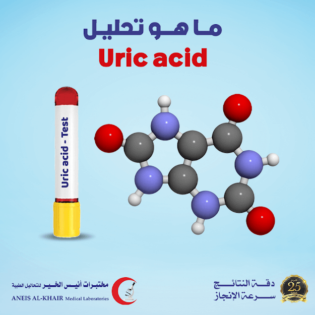 ما هو تحليل uric acid